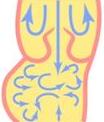 異常な血管弁　Abnormal blood vessel valve